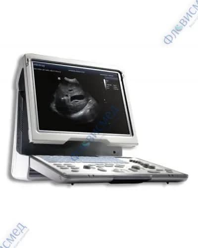 УЗИ аппарат Mindray DP-50 Color